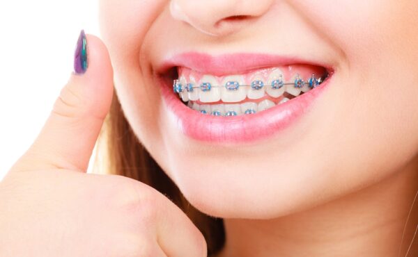 Orthodontics