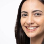 Before and after professional whitening treatment