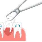 Your Wisdom Teeth Guide: Signs It's Time for Removal And How We Make It Gentle