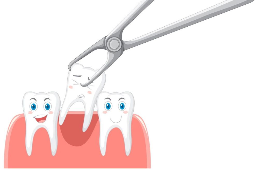 Your Wisdom Teeth Guide: Signs It's Time for Removal And How We Make It Gentle